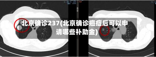 北京确诊237(北京确诊癌症后可以申请哪些补助金)-第2张图片