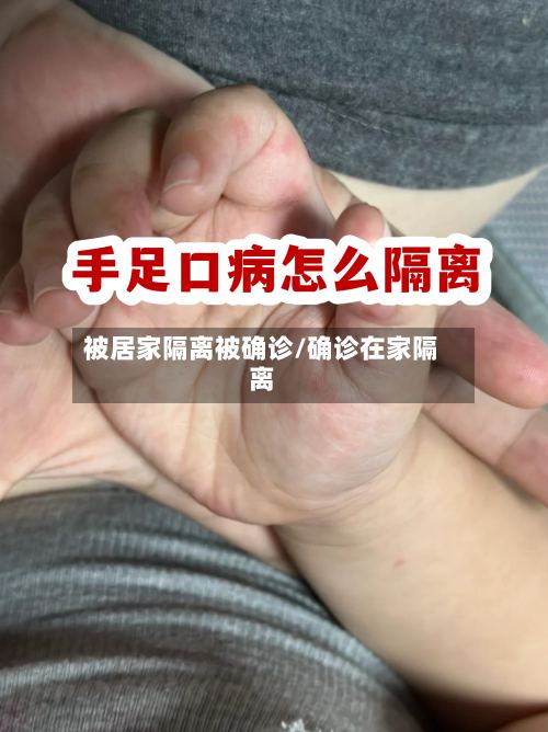 被居家隔离被确诊/确诊在家隔离