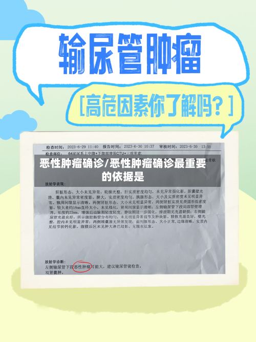 恶性肿瘤确诊/恶性肿瘤确诊最重要的依据是