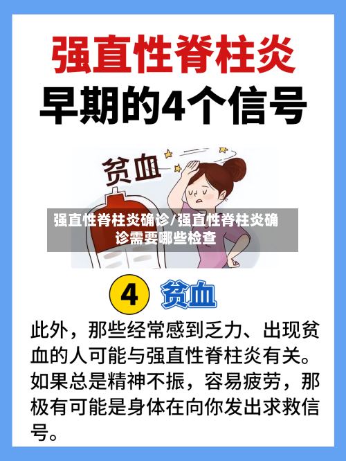 强直性脊柱炎确诊/强直性脊柱炎确诊需要哪些检查