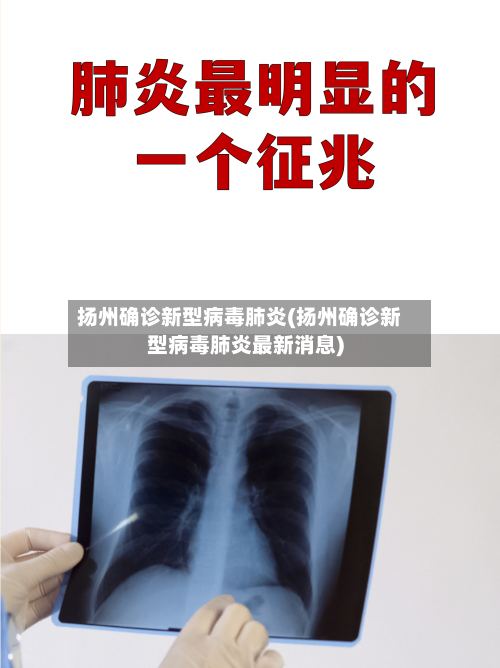 扬州确诊新型病毒肺炎(扬州确诊新型病毒肺炎最新消息)-第3张图片