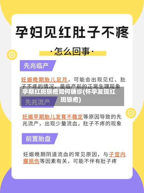 孕期红斑狼疮如何确诊(怀孕发现红斑狼疮)-第2张图片