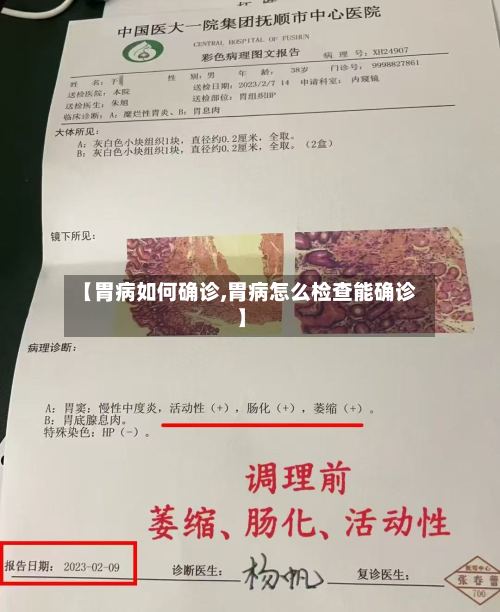 【胃病如何确诊,胃病怎么检查能确诊】-第3张图片