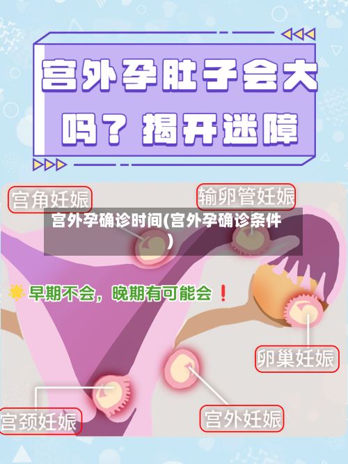 宫外孕确诊时间(宫外孕确诊条件)-第3张图片