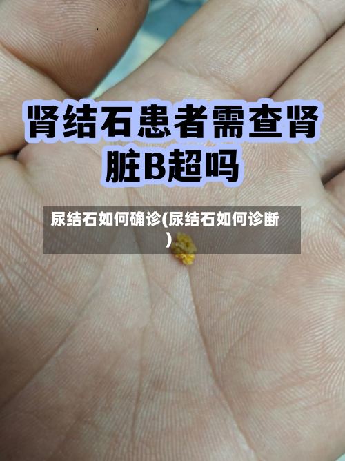 尿结石如何确诊(尿结石如何诊断)-第2张图片