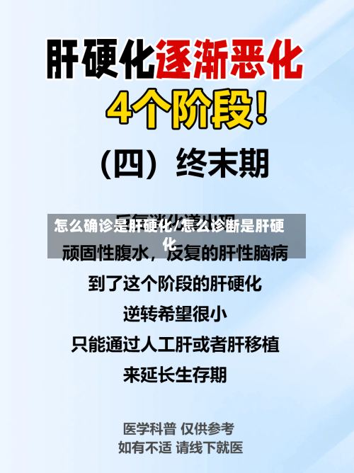 怎么确诊是肝硬化/怎么诊断是肝硬化-第2张图片