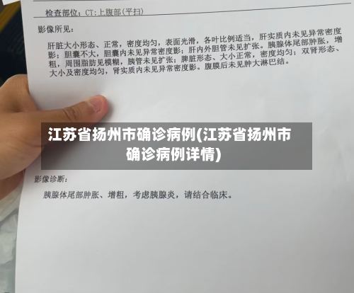 江苏省扬州市确诊病例(江苏省扬州市确诊病例详情)-第2张图片
