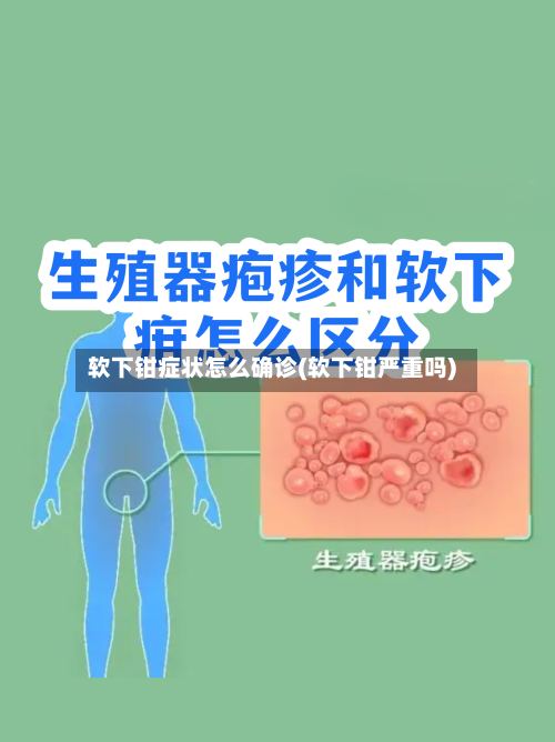 软下钳症状怎么确诊(软下钳严重吗)-第2张图片