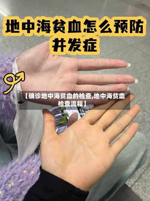 【确诊地中海贫血的检查,地中海贫血检查流程】-第2张图片