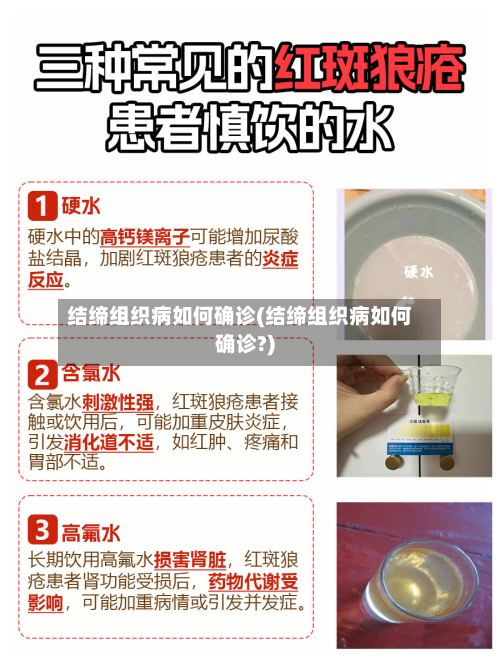 结缔组织病如何确诊(结缔组织病如何确诊?)-第3张图片