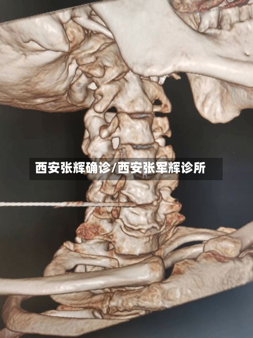 西安张辉确诊/西安张军辉诊所-第2张图片