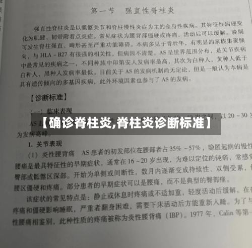 【确诊脊柱炎,脊柱炎诊断标准】-第2张图片
