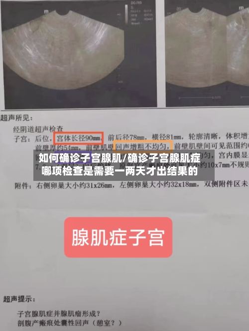 如何确诊子宫腺肌/确诊子宫腺肌症哪项检查是需要一两天才出结果的-第3张图片