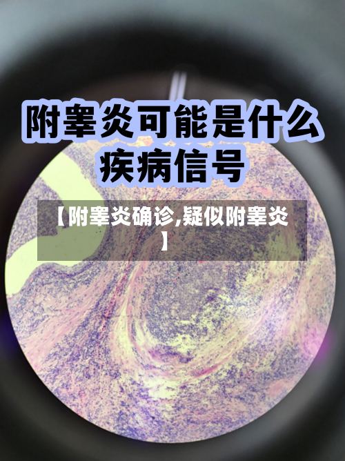 【附睾炎确诊,疑似附睾炎】-第2张图片
