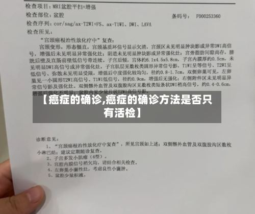 【癌症的确诊,癌症的确诊方法是否只有活检】-第2张图片