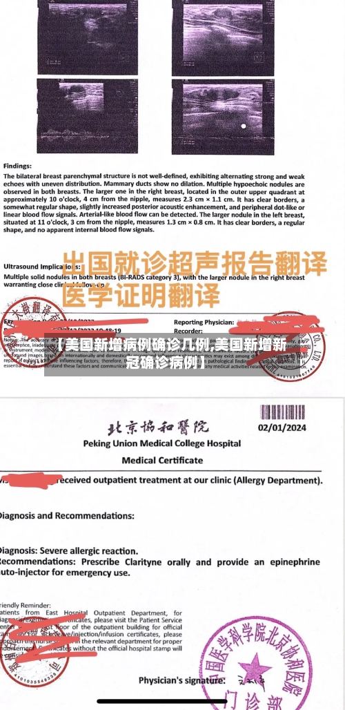 【美国新增病例确诊几例,美国新增新冠确诊病例】