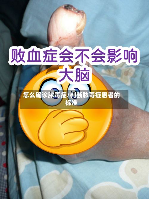 怎么确诊脓毒症/判断脓毒症患者的标准-第2张图片