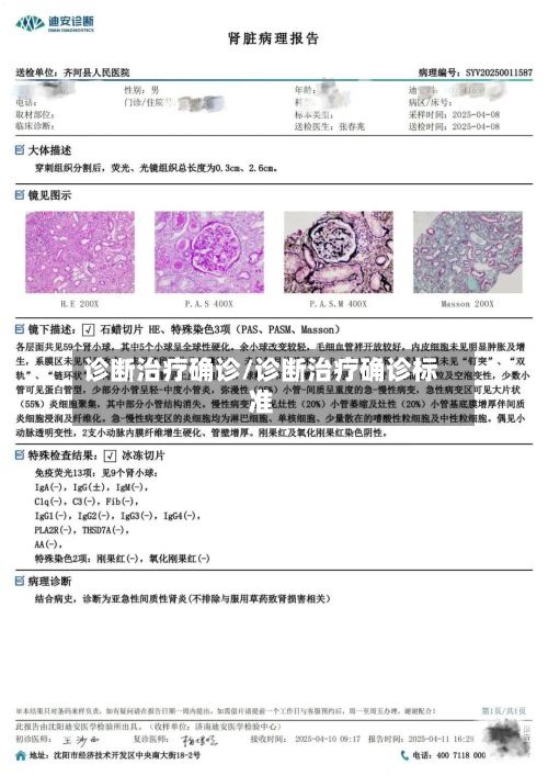 诊断治疗确诊/诊断治疗确诊标准