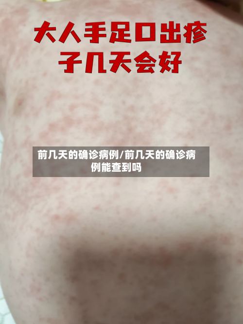 前几天的确诊病例/前几天的确诊病例能查到吗